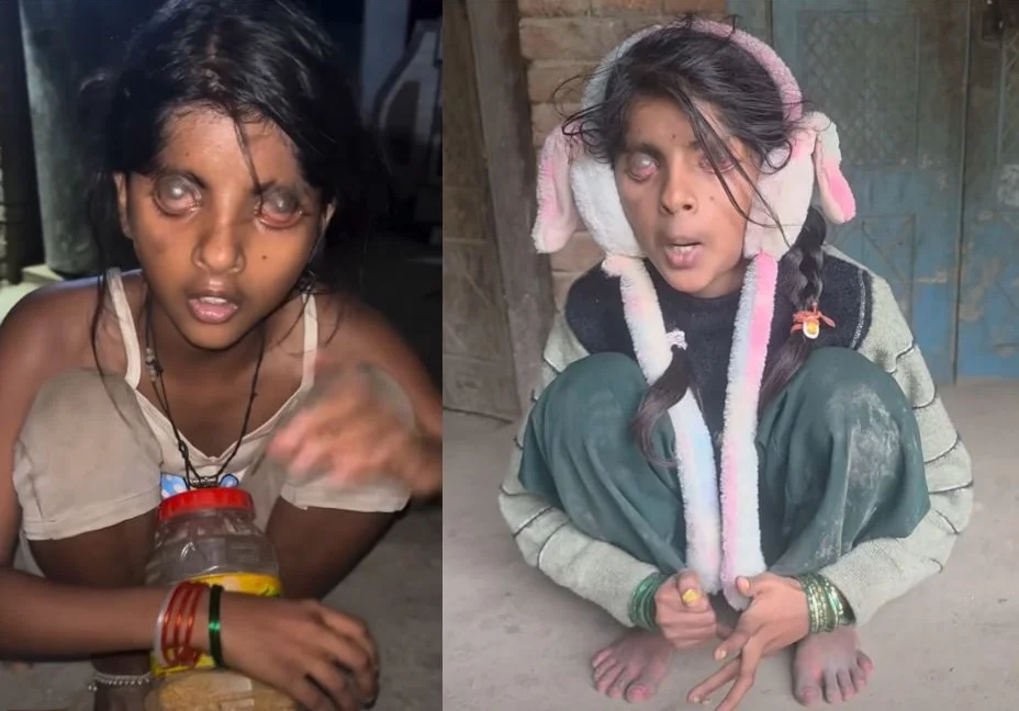 Ajude Natacha a Não Perder a Visão