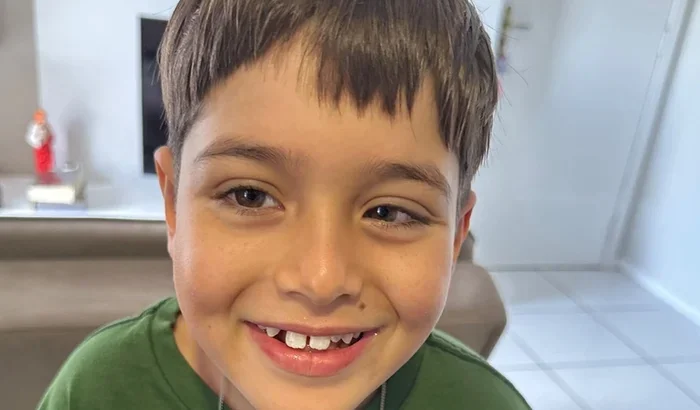 Bernardo, 5 anos, pode voltar a enxergar — mas precisa de ajuda agora