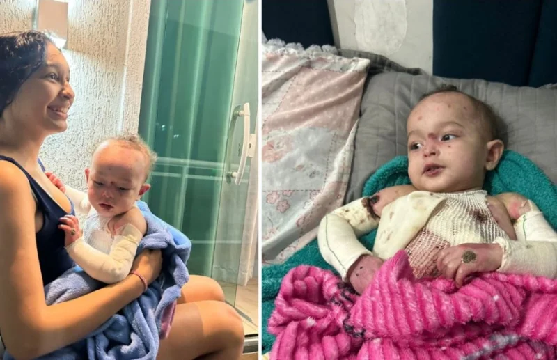 💚 Ajude Theo: bebê com Epidermólise Bolhosa precisa de cuidados diários